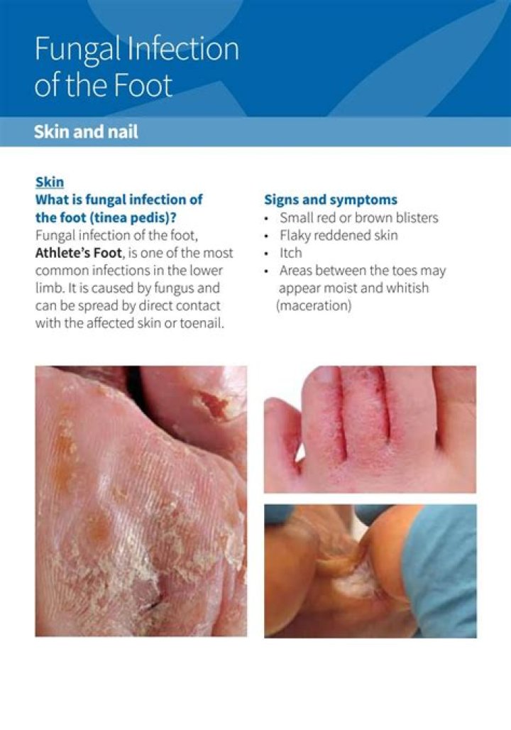 Can a plant recover from a fungal infection?