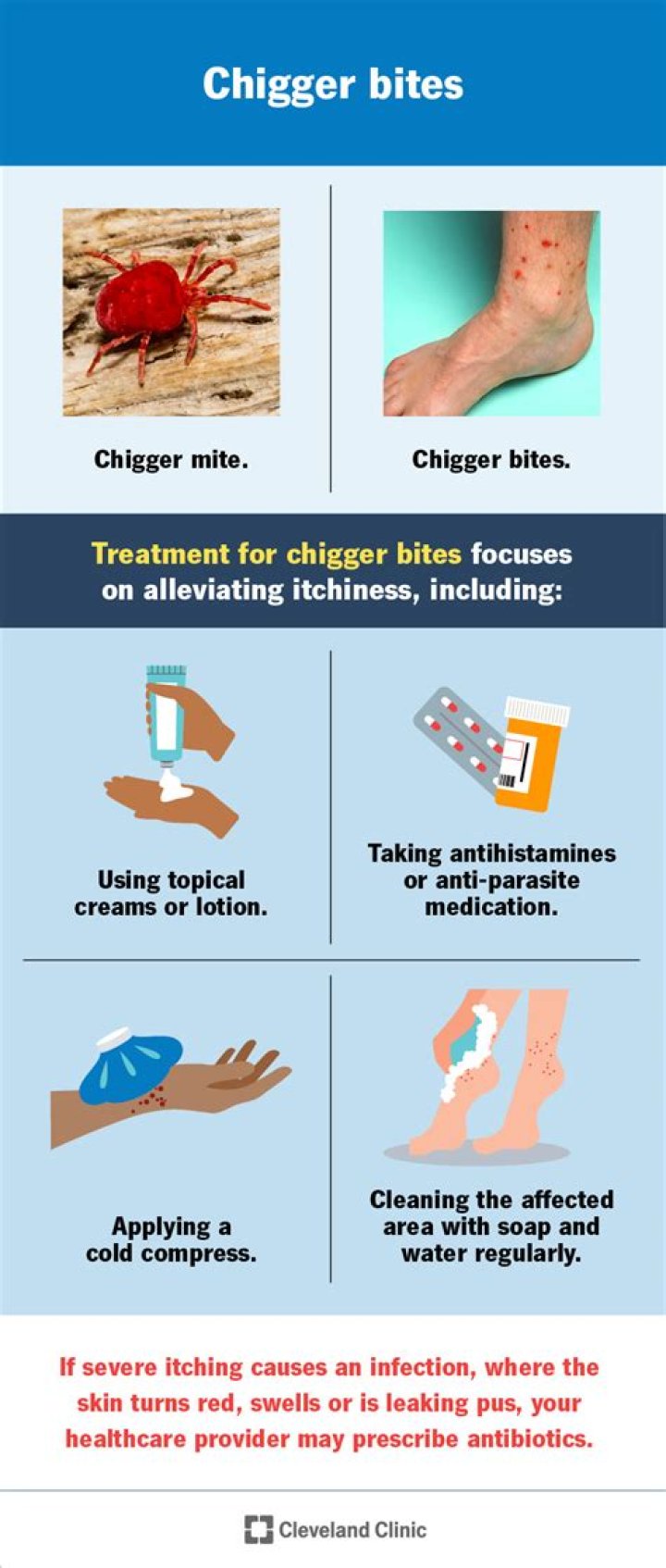 Does chlorine get rid of chiggers?