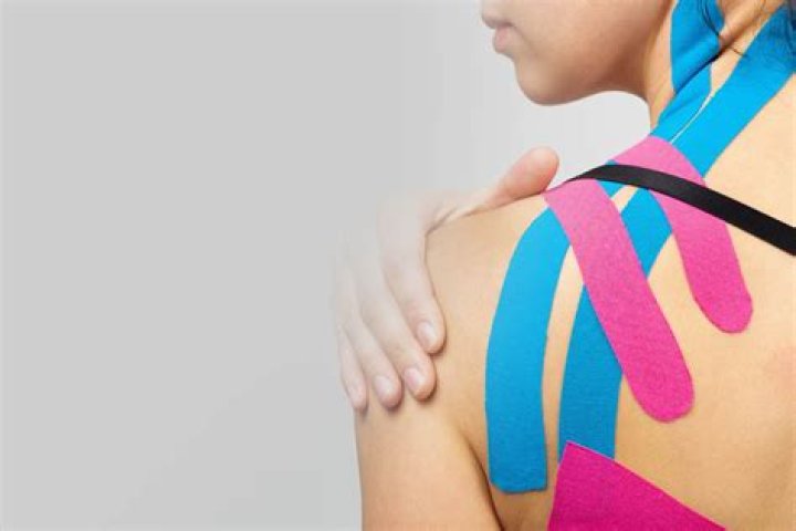 Does Kinesio tape really work?