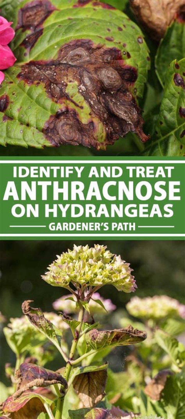 How do you treat anthracnose in trees?