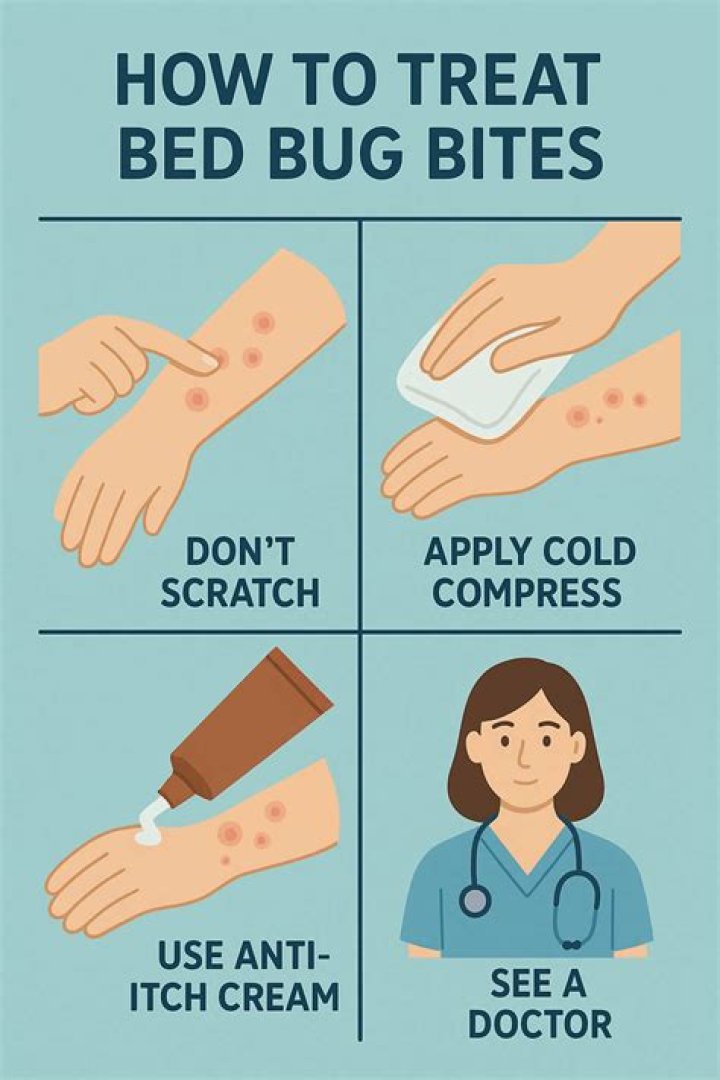 How do you treat lice bites?