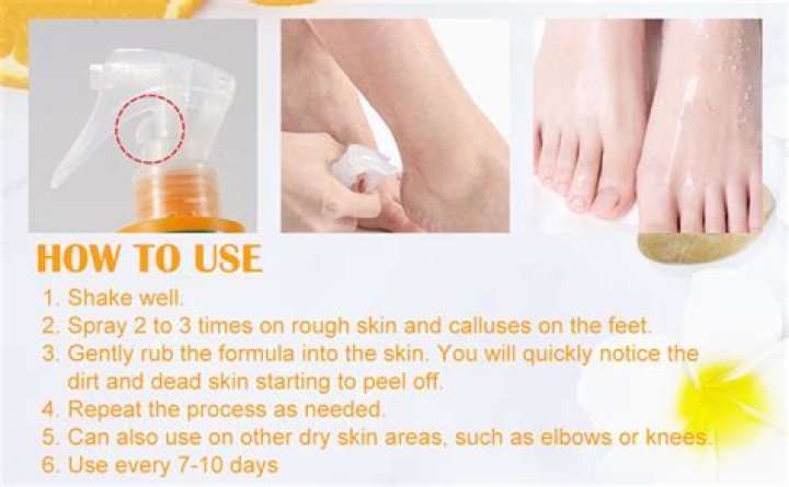 How do you treat peeling bark?