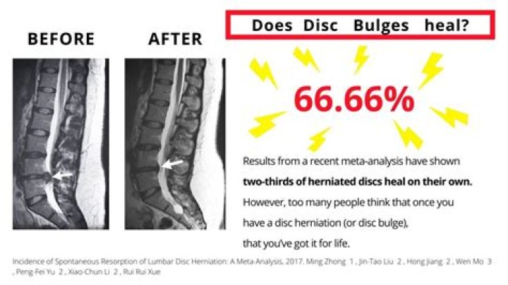 How long does it take for a disc to rot?