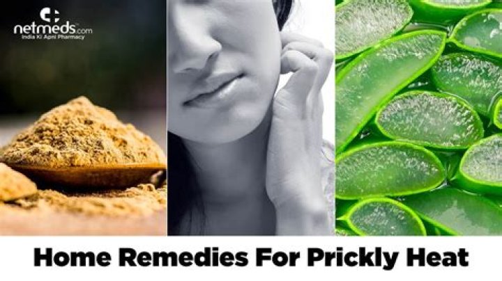 What can prickly heat be mistaken for?