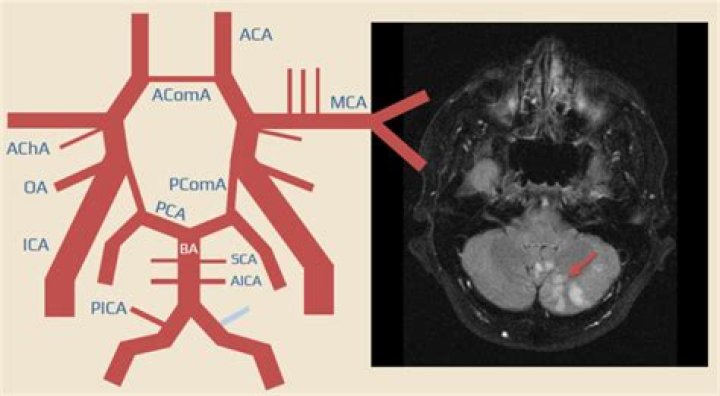 What do you need to know about the mca-c5?