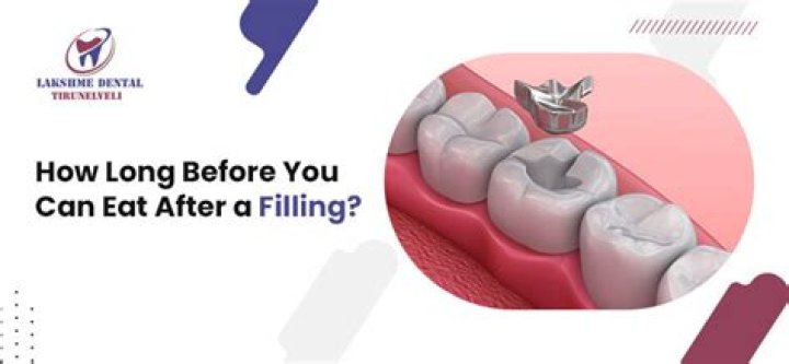 What not to eat after filling?