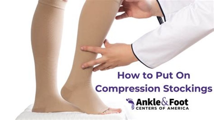 Why do compression flanges need lateral?